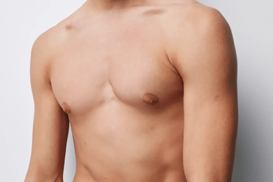 Can Gynecomastia Cause Impaired Sexual Function