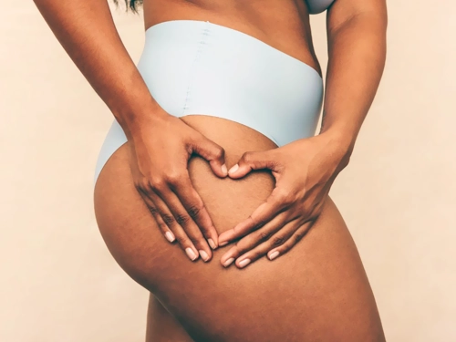 Lipödem Ameliyatı Sonrası Nelere Dikkat Edilmeli?