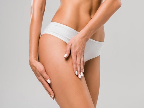 Vaserlipo (Vaser Liposuction) ile Lipödem Tedavisi